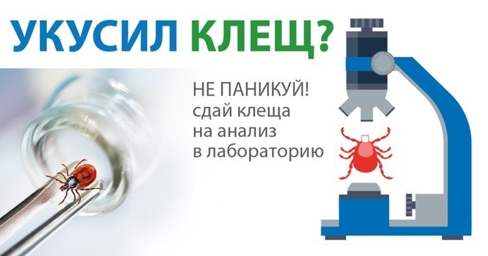 Где провести лабораторное исследование клещей в городе Воткинск?.